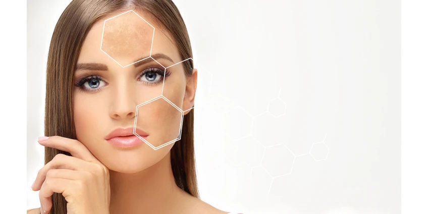 Mezoterapie: s jehlami nebo bez? Porovnejme účinnost a komfort