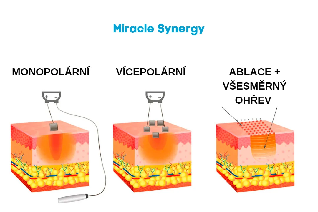 Přístroj pro mikrojehličkovou radiofrekvence 5