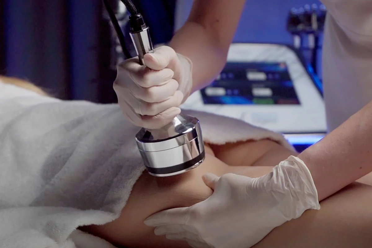 Výsledky a trvání efektu: co by měli klienti očekávat