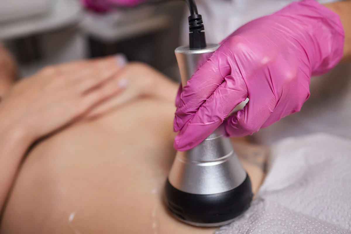 kdy je vakuová masáž lepší volbou