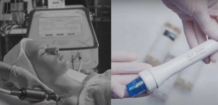 Šetrné přístrojové ošetření pro citlivou a alergickou pleť