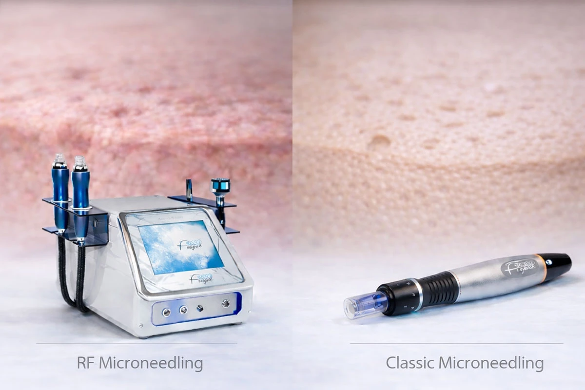 RF microneedling nebo klasický microneedling