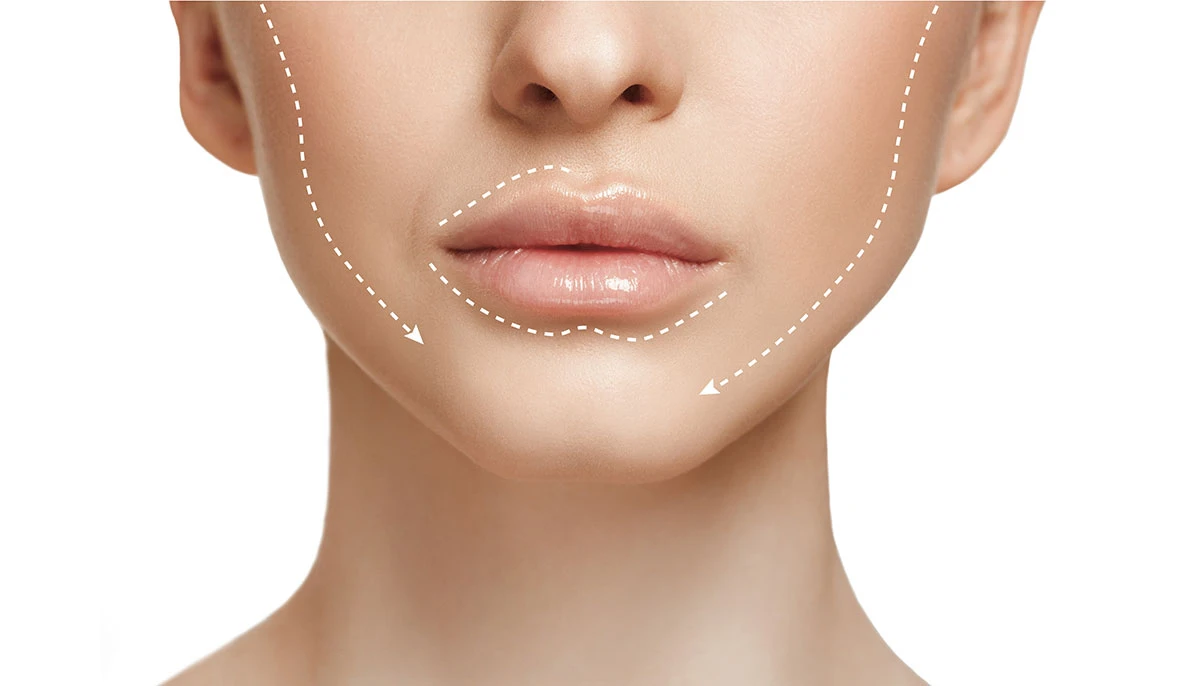 porovnání radiofrekvenčního liftingu a HIFU